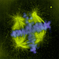 Figure 1 – Immunofluorescence shows the abnormal division that occurs in tumor cells with too many centrosomes.